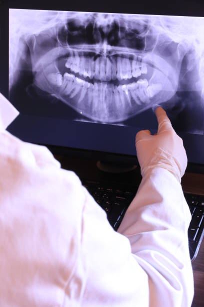 Best Emergency Treatment for Toothache in Denton, MD