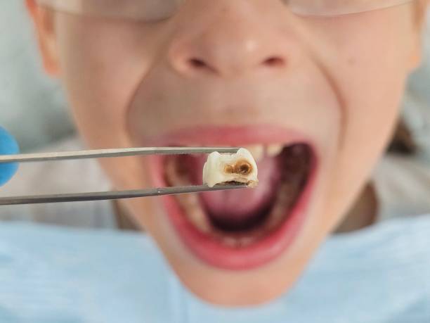 Best After-Hours Emergency Dentist in Denton, MD